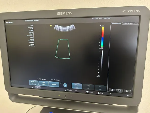 Ultrasuono SIEMENS ACUSON X700