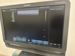 Ultrasuono SIEMENS ACUSON X700